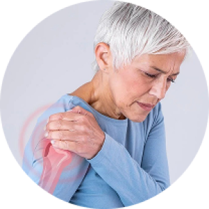 Viêm quanh khớp vai