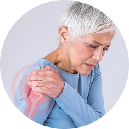 Viêm quanh khớp vai